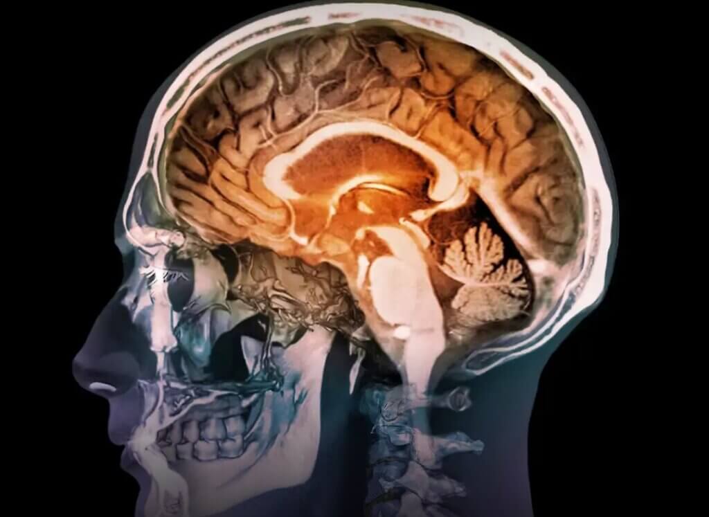 Atrofia cognitiva: A influência silenciosa da IA no cérebro Cérebro humano ilustrado em destaque, representando funções cognitivas como memória, atenção e raciocínio, associado ao impacto da inteligência artificial na atividade mental e no processamento de informações.